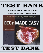 ECGs MADE EASY 6TH EDITION BY BARBARA AEHLERT TEST BANK
