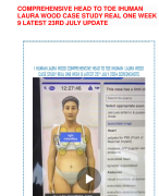 COMPREHENSIVE HEAD TO TOE IHUMAN LAURA WOOD CASE STUDY  DALTON