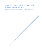 Grading and Staging of tumors & carcinoma of the breast