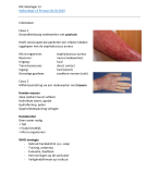 Microbiologie hoorcollege 13 - Infectie en Ontstekingen 
