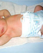 Definitie van kindermishandeling