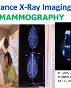  Digital Mammography