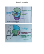 botten in het gezicht (pathologie)