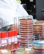 20/80 Science verslag Microbiologie HAVO4 8.2